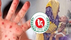 হামের উপসর্গ নিয়ে আরও ৭ শিশুর মৃত্যু