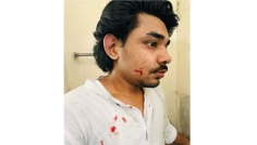 গাজীপুরে ছাত্রশক্তি নেতার ওপর ছাত্রদল নেতার হামলা
