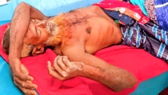 ডুমুরিয়ায় মসজিদের মুয়াজ্জিনকে গলা কেটে হত্যার চেষ্টা, এলাকায় আতঙ্ক